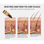 Disaar – Hair Essential Oil Anti – Hair loss