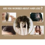 Disaar – Hair Essential Oil Anti – Hair loss