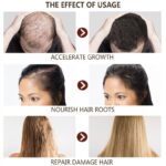 Disaar – Hair Essential Oil Anti – Hair loss