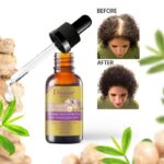 Disaar – Hair Essential Oil Anti – Hair loss